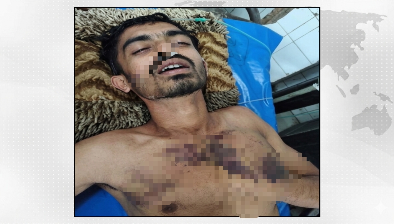 কাদা পানি ছিটানোকে কেন্দ্র করে যশোরে ট্রাক চালককে রডপেটা